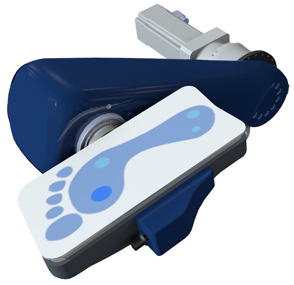 Mechanische Kniescheibe